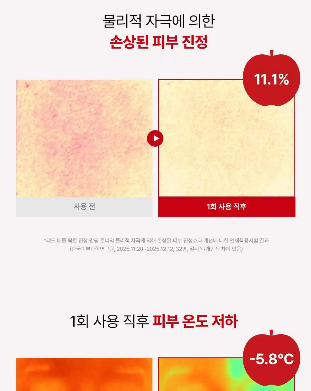 [NEW/단독기획] rdrd 레드 애플 락토 진정 팝핑 토너 95g 응급진정 KIT 기획 상세페이지 15